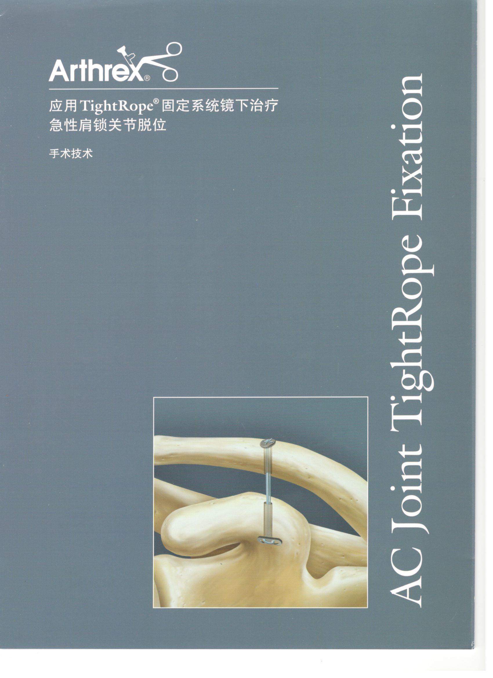 應用(yòng)TightRope固定系統鏡下(xià)治療 急性肩鎖關節脫位