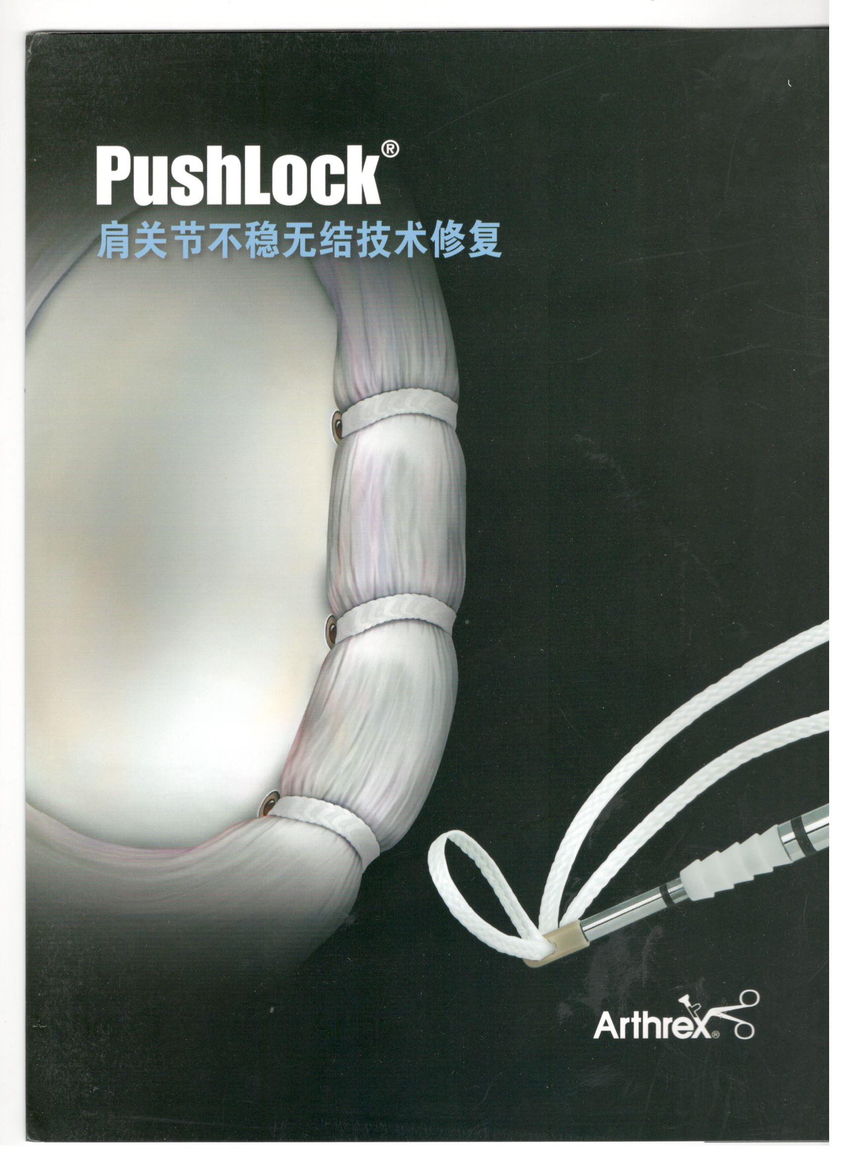 Pushlock肩關節不(bù)穩無結技(jì)術(shù)修複