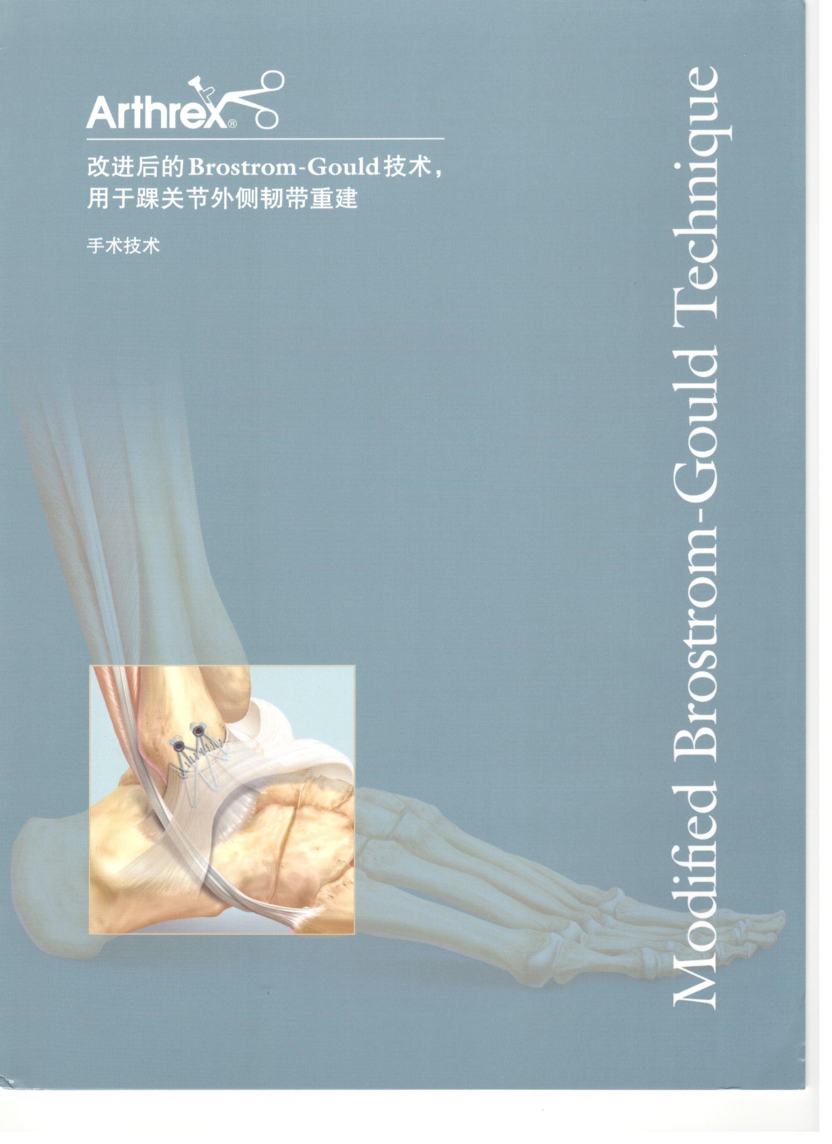 改進後的(de)Brostrom-Gould用(yòng)于踝關節外(wài)側韌帶重建